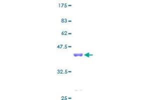 PFDN6 Protein (AA 1-129) (GST tag)