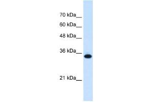 SLC25A38 antibody used at 0. (SLC25A38 antibody  (Middle Region))