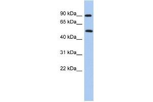 PRMT7 antibody used at 1 ug/ml to detect target protein. (PRMT7 antibody  (N-Term))