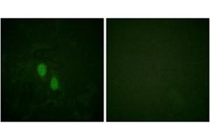 Immunofluorescence analysis of HeLa cells, using hnRPD Antibody .