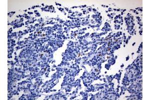 Image no. 1 for anti-Zinc Finger E-Box Binding Homeobox 2 (ZEB2) (AA 1-350) antibody (ABIN1490760) (ZEB2 antibody  (AA 1-350))