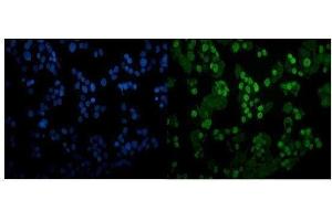 IF analysis of CEBP Alpha/CEBPA using anti- CEBP Alpha/CEBPA antibody (ABIN7599996).