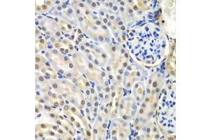 Immunohistochemistry of paraffin-embedded mouse kidney using SNRPD2 antibody. (SNRPD2 antibody  (AA 1-118))