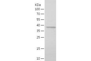 Western Blotting (WB) image for Tafazzin (TAZ) (AA 135-292) protein (His-IF2DI Tag) (ABIN7282933) (TAZ Protein (AA 135-292) (His-IF2DI Tag))