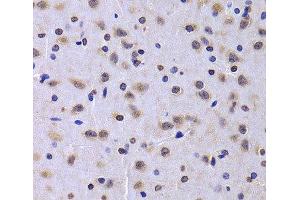 Immunohistochemistry of paraffin-embedded Rat brain using NUDC Polyclonal Antibody at dilution of 1:100 (40x lens). (NUDC antibody)