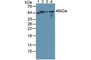 Figure. (BCKDK antibody  (AA 44-223))