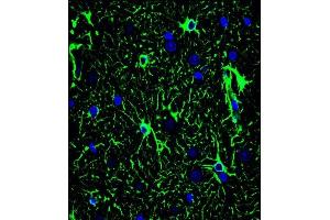 Confocal immunofluorescent analysis of GF Antibody (ABIN659067 and ABIN2838068) with brain tissue followed by Alexa Fluor® 488-conjugated goat anti-mouse lgG (green). (GFAP antibody)