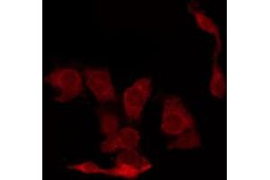ABIN6267448 staining A2780 by IF/ICC. (CDK2 antibody  (pThr160))