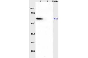 Lane 1: rat brain lysates Lane 2: rat liver lysates probed with Anti CDKAL1 Polyclonal Antibody, Unconjugated (ABIN873056) at 1:200 in 4 °C. (CDKAL1 antibody  (AA 375-460))