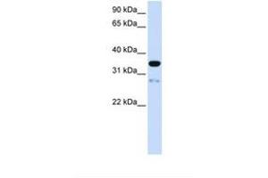 Image no. 1 for anti-Transmembrane Protein 38A (TMEM38A) (AA 74-123) antibody (ABIN6738623) (TMEM38A antibody  (AA 74-123))