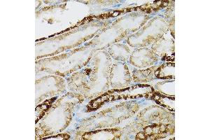 Immunohistochemistry of paraffin-embedded rat kidney using CD117/c-Kit antibody (ABIN6133454, ABIN6142896, ABIN6142898 and ABIN6213818) at dilution of 1:150 (40x lens).