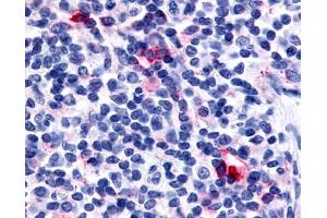 Anti-CXCR6 antibody IHC of human tonsil, interfollicular zone. (CXCR6 antibody  (C-Term))