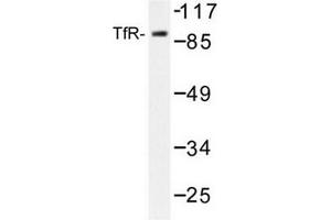 Image no. 2 for anti-Transferrin Receptor (p90, CD71) (TFRC) antibody (ABIN272097) (Transferrin Receptor antibody)