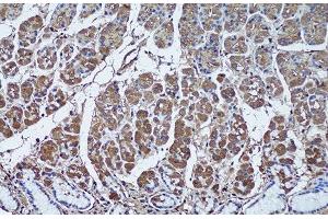 Immunohistochemistry of paraffin-embedded Human stomach using SFRP1 Polyclonal Antibody at dilution of 1:50 (20x lens). (SFRP1 antibody)