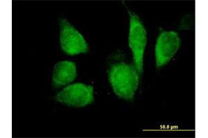 Immunofluorescence of purified MaxPab antibody to CDKN1B on HeLa cell. (CDKN1B antibody  (AA 1-198))