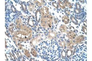 TLR6 antibody was used for immunohistochemistry at a concentration of 4-8 ug/ml to stain Epithelial cells of renal tubule (arrows) in Human Kidney. (TLR6 antibody  (Middle Region))