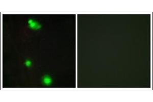 Immunofluorescence analysis of MCF7 cells, using SFRS3 Antibody.