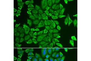 Immunofluorescence analysis of HeLa cells using APEH Polyclonal Antibody (APEH antibody)