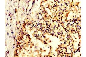 IHC image of ABIN7156276 diluted at 1:200 and staining in paraffin-embedded human lung tissue performed on a Leica BondTM system. (Pyrophosphatase (Inorganic) 1 (PPA1) (AA 59-173) antibody)