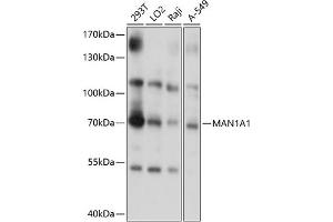 Western blot analysis of extracts of various cell lines, using M antibody (0830) at 1:1000 dilution. (MAN1A1 antibody  (AA 70-190))