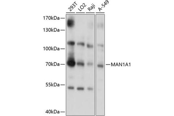 MAN1A1 Antikörper  (AA 70-190)