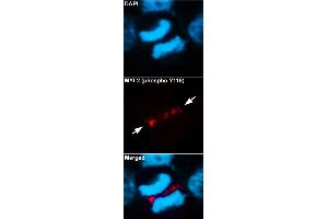 Immunofluorescent staining of methanol-fixed U87 cells using MYL2 (phospho Y118) polyclonal antibody  at 1:100-1:200 dilution. (MYL2 antibody  (pTyr118))