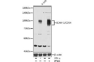 Western blot analysis of extracts of A-549 cells, using ICAM-1/CD54 antibody (ABIN6129231, ABIN6142118, ABIN6142120 and ABIN6221235) at 1:1000 dilution. (ICAM1 antibody  (AA 250-480))
