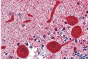 Human Brain, Cerebellum (formalin-fixed, paraffin-embedded) stained with EMX2 antibody ABIN462168 followed by biotinylated goat anti-rabbit IgG secondary antibody ABIN481713, alkaline phosphatase-streptavidin and chromogen. (EMX2 antibody  (N-Term))