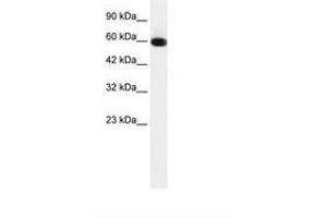 Image no. 1 for anti-GLIS Family Zinc Finger 2 (GLIS2) (AA 183-232) antibody (ABIN6735915)