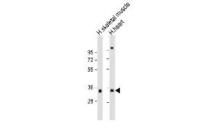 All lanes : Anti-T Antibody (C-Term) at 1:2000 dilution Lane 1: human skeletal muscle lysate Lane 2: human heart lysate Lysates/proteins at 20 μg per lane. (TPM3 antibody  (AA 245-276))