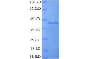 SDS-PAGE (SDS) image for D-Amino Acid Oxidase Activator (DAOA) (AA 1-153), (full length) protein (GST tag) (ABIN4974364) (DAOA Protein (AA 1-153, full length) (GST tag))