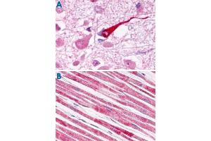 Immunohistochemistry (Formalin/PFA-fixed paraffin-embedded sections) of human brain (A) and human heart tissue (B) with GALR1 polyclonal antibody . (Galanin Receptor 1 antibody  (Extracellular Domain))
