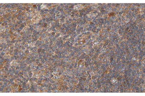 CIB2 antibody  (Internal Region)