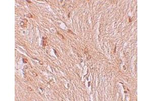 Immunohistochemistry (IHC) image for anti-Zinc Finger and BTB Domain Containing 3 (ZBTB3) (C-Term) antibody (ABIN1030811) (ZBTB3 antibody  (C-Term))