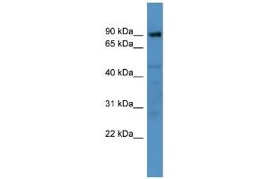 WB Suggested Anti-Adam22 Antibody Titration:  0. (ADAM22 antibody  (N-Term))
