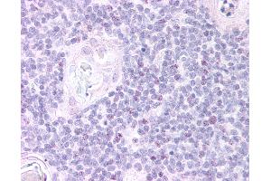 Anti-FOXN1 antibody IHC of human thymus, medulla. (FOXN1 antibody  (AA 635-648))