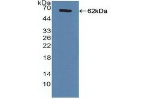 Western Blotting (WB) image for anti-Nuclear Receptor Subfamily 1, Group H, Member 4 (NR1H4) (AA 211-486) antibody (ABIN7434584)