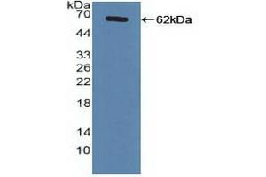 Detection of Recombinant FXR, Human using Polyclonal Antibody to Farnesoid X Receptor (FXR) (NR1H4 antibody  (AA 211-486))