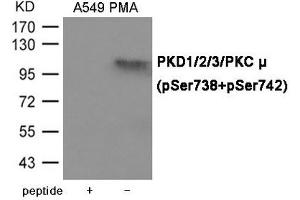Western blot analysis of extracts from A549 cells with PMA using PKD1/2/3/PKC μ (Phospho-Ser738+Ser742) Antibody. (PRKD1/PRKD2/PRKD3 (pSer738), (pSer742) antibody)