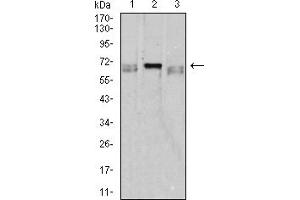 Western blot analysis using CD42B mouse mAb against K562 (1), HL-60 (2), and Ramos (3) cell lysate. (CD42b antibody  (AA 17-183))