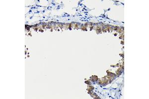 Immunohistochemistry of paraffin-embedded mouse lung using FUC Rabbit pAb (ABIN6127916, ABIN6140809, ABIN6140811 and ABIN6215812) at dilution of 1:200 (40x lens). (FUCA2 antibody  (AA 118-467))