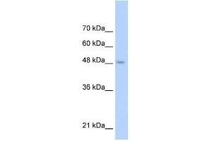 WB Suggested Anti-TLR6 Antibody Titration: 0. (TLR6 antibody  (Middle Region))