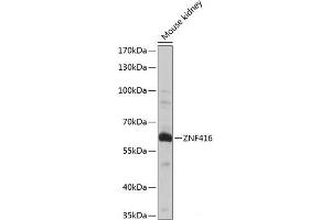 Western blot analysis of extracts of Mouse kidney using ZNF416 Polyclonal Antibody at dilution of 1:1000. (ZNF416 antibody)