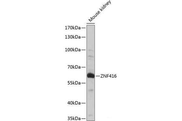 ZNF416 抗体