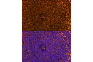 Immunofluorescence analysis of Rat spleen using FB antibody (ABIN6129339, ABIN6140465, ABIN6140466 and ABIN6224941) at dilution of 1:100. (FAM65B antibody  (AA 1-210))