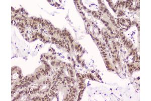 IHC analysis of CRM1 using anti-CRM1 antibody . (XPO1 antibody  (AA 966-1071))