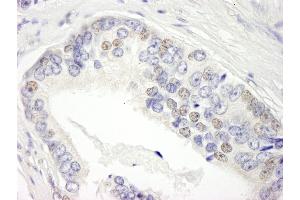 Immunohistochemistry (IHC) image for anti-Bromodomain Containing 3 (BRD3) (AA 676-726) antibody (ABIN7448441)