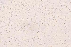 Immunohistochemistry analysis of paraffin-embedded mouse substantia nigra using UBLCP1 (ABIN7076132) at dilution of 1: 4200 (UBLCP1 antibody)