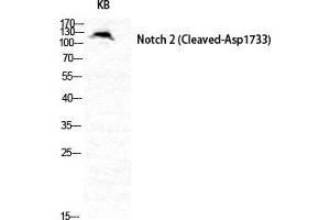 Western Blot (WB) analysis of specific cells using Cleaved-Notch 2 (D1733) Polyclonal Antibody. (NOTCH2 antibody  (Asp1733, cleaved))