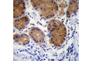 Immunohistochemistry analysis in human stomach tissue (Formalin-fixed, Paraffin-embedded) using MORN5 Antibody (C-term), followed by peroxidase conjugated secondary antibody and DAB staining. (MORN5 antibody  (C-Term))